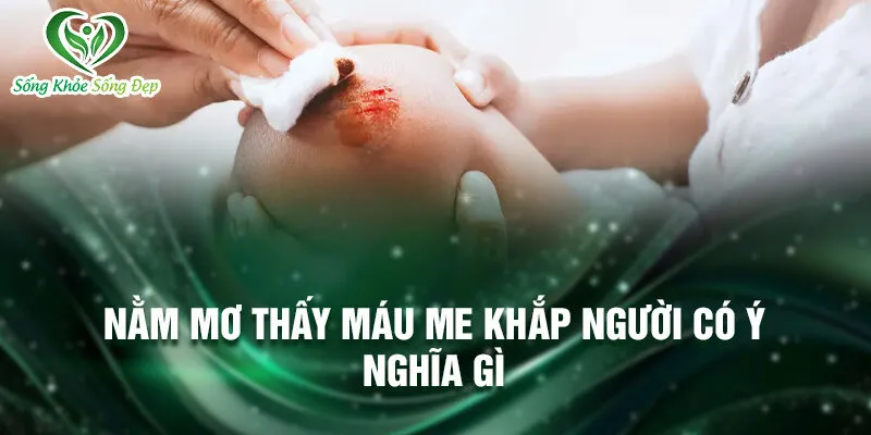 Nằm Mơ Thấy Máu Me Khắp Người: Bí Ẩn Và Giải Đáp 4 Nằm mơ thấy máu me khắp người có ý nghĩa gì